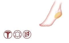 Podpiętki na ostrogi piętowe Heelmed Kaps – skóra owcza + pianka lateksowa, odciążenie pięty